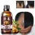 Import Natural Ginger Anti Hair Loss Germinal Serum Hair Growth Essential Oil from China
