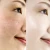Import SENANA Hyaluronic Acid anti aging moisturizing whitening essence shrink pore nicotinamide ampoule serum for skin care from China