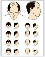 Wholesale virgin remy human hair toupee for men