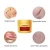 Import Vanecl Acne Scar Removal for Men &amp; Women- Stretch Marks Relief and Burns Repair Scars- Stretch Mark Removal Gel from China