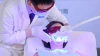 High quality dental clinic use teeth whitening blue led light machine