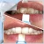 Import Most Popular Products Oral Hygiene For Teeth Whitening Canada from China