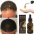 Import Private label bald hair growth Hair follicle regrowth Germinal Serum Essence Oil from China