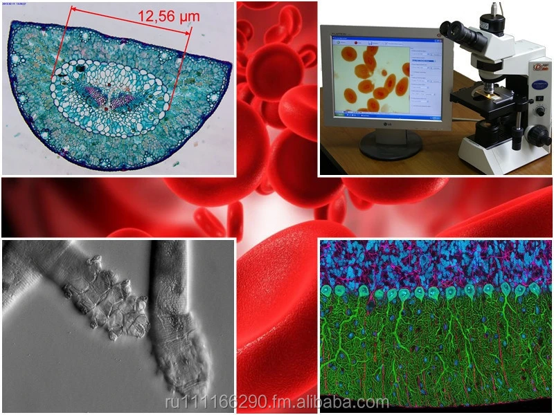 Dianel-Micro-software for automation,visualization,classification and evaluation of laboratory researches on digital microscope