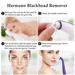 Electric vacuum suction pores cleansing device lady beauty skin care handheld blackhead removal tool