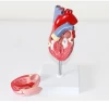 Hot Sell Atherosclerosis Plastic Human Heart Model for Medical Teaching