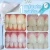Import Nano tecnologia 2021 Zero peroxide New Innovative product Best Teeth tooth whitening cleaning kit from China