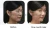 Factory OEM Polycaprolactone Dermal Filler Collagen Stimulator for Facial Wrinkles Treatment