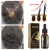 Import Manufacturers private label black hair edge growth oil Hair Scalp oil Helps absorb Hair Growth Oil Serum from China