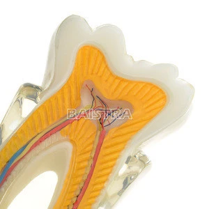 Medical Student Use for Dental Study / Teaching / Training Tooth Nerve Anatomy Model