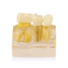 teeth implant model for Doctor-patient communication