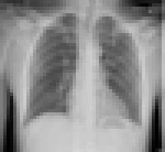 X-ray detection medical equipment CRT Gd2O2S:Tb luminescent phosphor