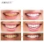 AuQuest Teeth whitening kits private logo/led teeth whitening lamp/home teeth whitening kit