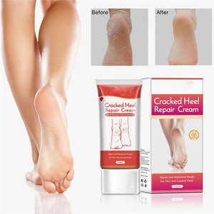 OEM ODM hand and foot care repair cream anti-drying Anti Chapping Wrinkle Treatment Skin Cracking foot cream for cracked heels