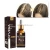 Import Private Label Faster Hair Growth Anti Hair Loss Treatment Hair Oil from China