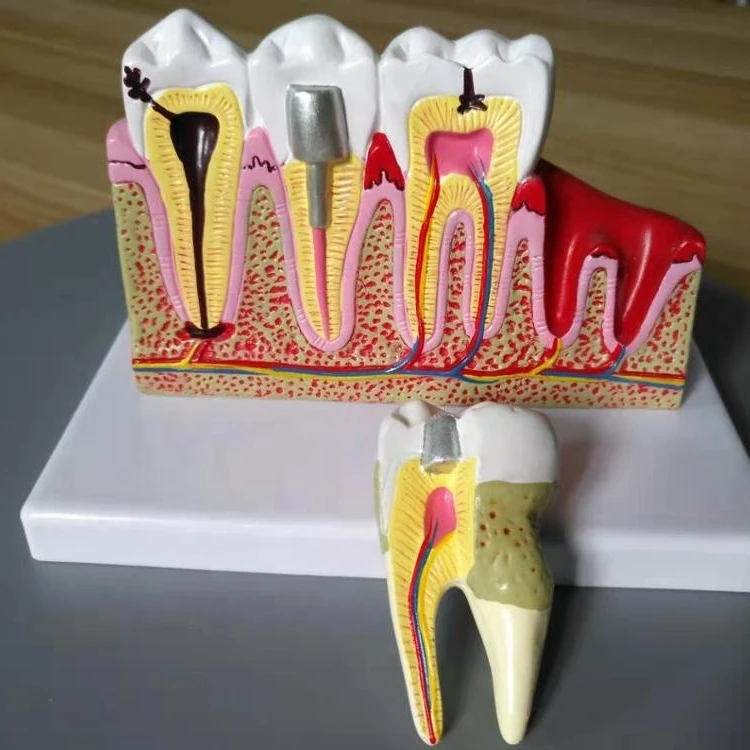 factory direct dental pulp disease model 2 parts of medical science subject