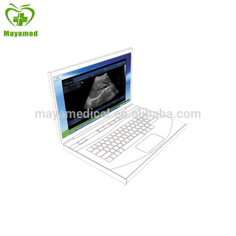 MY-A010 USB Ultrasound Probe Price Ultrasound B Scanner Box with 3D Imaging