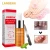 Import Hot selling LANBENA Nail Repair Essence Serum Fungal Nail Treatment cream Hands and Feet Care from China