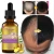 Herbal Oil Fast Effect Hair Loss Treatment Ginger Germinal Wild Hair Growth Essence