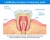 LANBENA Teeth Whitening Essence Liquid Oral Hygiene Cleaning Remove Plaque Stain Brighten Tooth Whitening Oral Hygiene