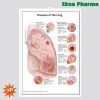 3D Medical Human Anatomy Wall Charts / Poster - Diseases of the lung