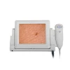 Hot sale skin hair camera scanner analyzer with LCD