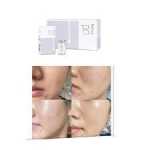 Korean Facial Whitening and Firming Serum Bellona Pcl for Skin Rejuvenation Whitening Anti-Wrinkle