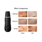 Amazon hotsell skin lifting ultrasonic facial skin scrubber wrinkle removal skin scrubber ultrasonic