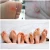 Import Chinese Traditional Medical Hand Foot Corn Cocoon Sticker Remove Hand Corn Dead Skin PediCure from China