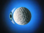 Bio-Osteon Hydroxyapatite Orbital Implant