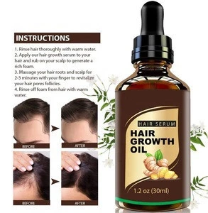 Private Label Anti Loss Popular Natural Hair Growth Oil for Women and Men