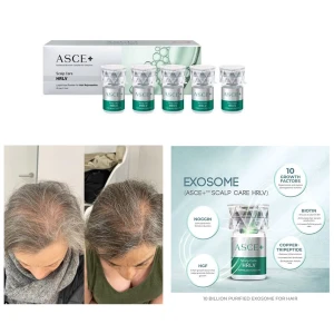 Korean ASCE HRLV for Scalp Care and Anti Hair Loss hair booster with exosome