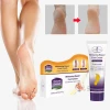 Aichun foot care chapped repair cream whitening moisturizing soothing foot cream