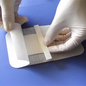Better bacterial barrier and moisture permeability medical  TPU film for wound dressing