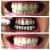 Import Hot Sell Tooth Cleaning Activated Charcoal Organic Coconut Shell Charcoal Bleaching Teeth Whitening Powder from China