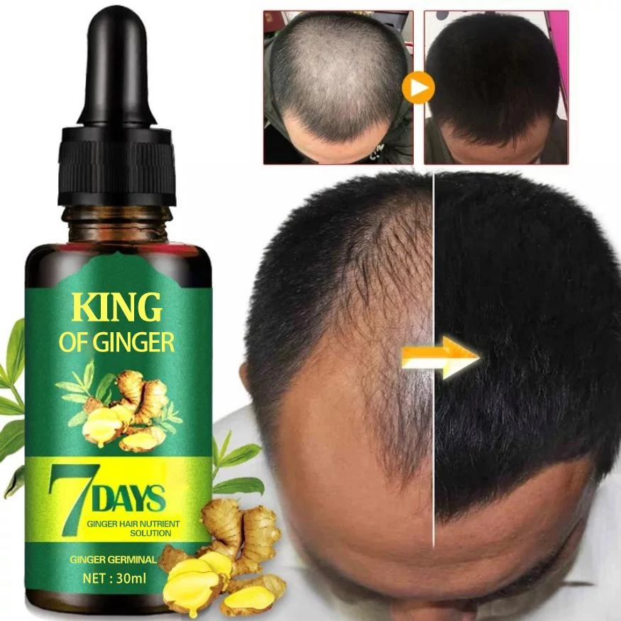 private label hair care treatment essential oils anti hair loss ginger hair growth oil