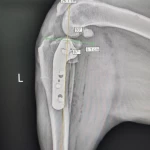 Veterinary Implants Medical TPLO Locking Plate