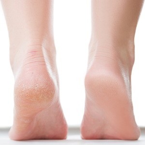 Glass Foot File nano Dead Skin Callus Remover Foot Care Pedicure Tool For Heels
