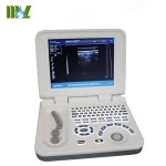 Compact Version Tablet Ultrasound Scan Machine / MSLPU26 Factory Price Portable Ultrasound Machine