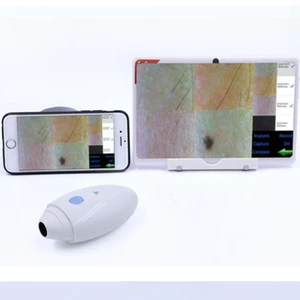 porable magic mirror wireless wifi skin &amp; scalp Analyzer