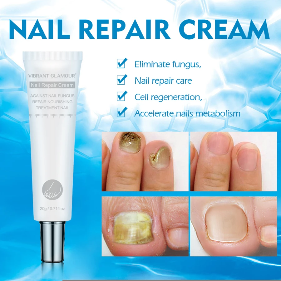 Wholesale Nail Care Repair Cream Toenail Fungus Nair Repair Cream Anti Fungal Nail Cream