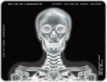 agfa dt2b 14*17inch x-ray film,dry film free blue films, dry film x-ray dry film kenid medical equipment