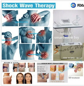 extracorporeal Pulse Activation Technology EPAT shock wave therapy equipment