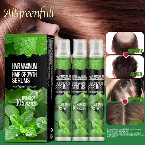 Allgreenfull Controls Hair Fall Fast Hair Growth Oil OEM/ODM