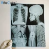8*10 Inch Medical Dry X-Ray Film For Inkjet Printers