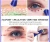 Import Beauty Personal Care Mini Ionic Eye Wrinkle Removal Device Eye Massager Anti-wrinkle Machine With Battery Operated from China