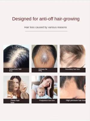 Chinese Factory Hair Repair Serum Hair Growth With Best Prices