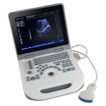High Quality Full Digital Ultrasound Scanner Diagnostic System 3.5MHz Convex Probe