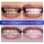 Import BREYLEE Teeth Whitening Powder Toothpaste Dental Tools White Teeth Cleaning Oral Hygiene Toothbrush Gel Remove Plaque Stains 30g from China
