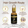 Custom Logo 100% Organic Natural Formula Nourishing Scalp Hair Growth Serum Rosemary Oil For Hair Growth